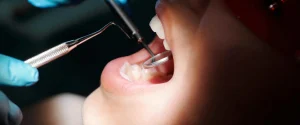 What Does it Mean When You Dream Your Teeth are Falling Out Spiritual