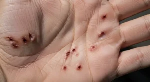 cultural and religious perspectives on hand cuts