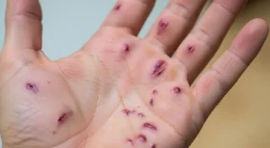 spiritual meanings of cuts on different parts of the hand